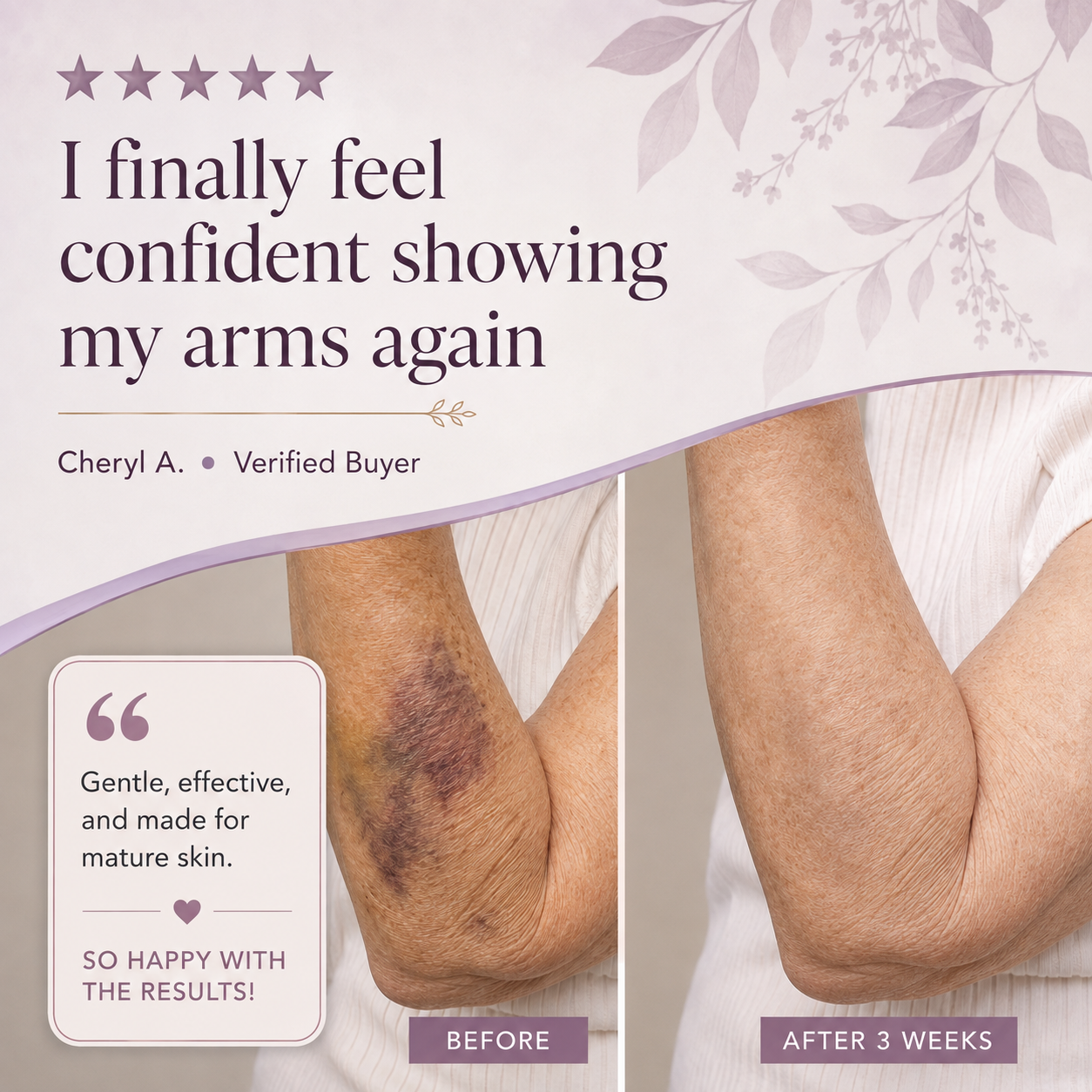 Skinergy Bruise Cream
